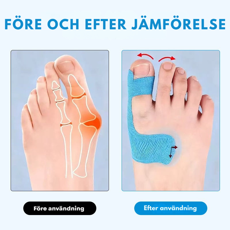 TånkomfortTape™ - Lindrar tåsmärtan mjukt och diskret