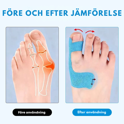 TånkomfortTape™ - Lindrar tåsmärtan mjukt och diskret